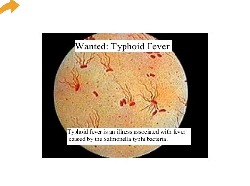 Typhoid fever story summary
